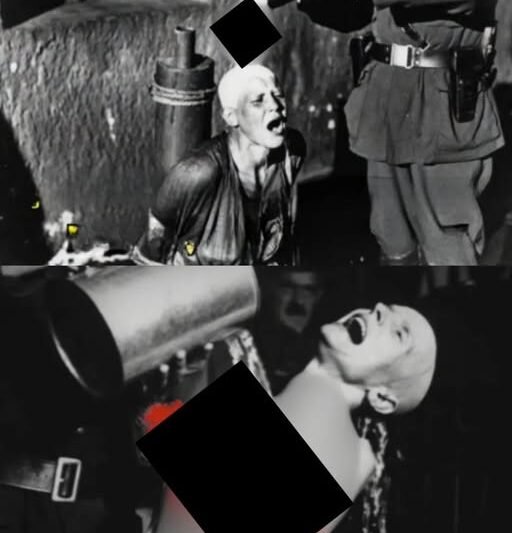 “”Toto bude trochu bolieť.”